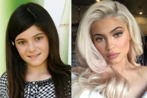 Kylie tiene un gran cambio en su rostro